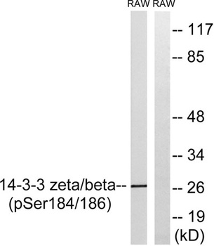 14-3-3 β/ζ (phospho Ser184/186) rabbit pAb