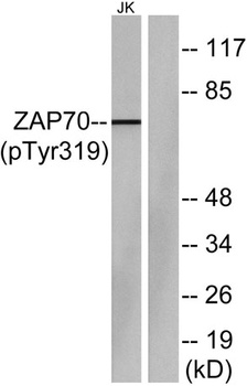 ZAP-70 (phospho-Tyr319) antibody