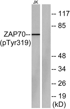 ZAP-70 (phospho Tyr319) rabbit pAb