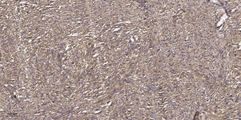 ZAP-70 (phospho Tyr319) rabbit pAb