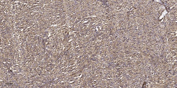 ZAP-70 (phospho-Tyr319) antibody