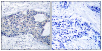 ZAP-70 (phospho Tyr493) rabbit pAb