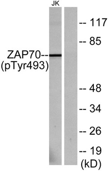 ZAP-70 (phospho-Tyr493) antibody