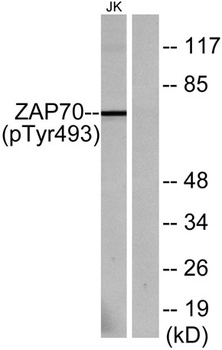 ZAP-70 (phospho Tyr493) rabbit pAb