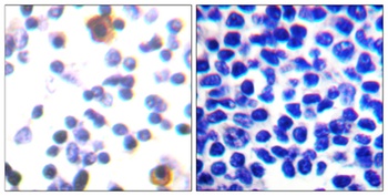 ZAP-70 (phospho-Tyr315) antibody