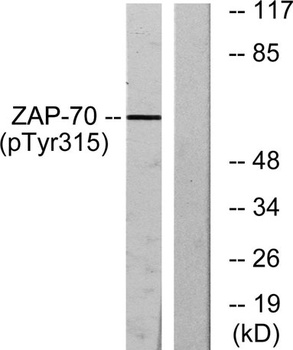 ZAP-70 (phospho Tyr315) rabbit pAb