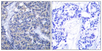 ZAP-70 rabbit pAb Antibody