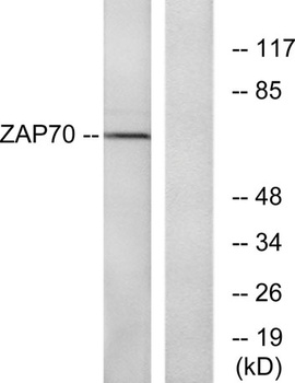 ZAP-70 rabbit pAb Antibody