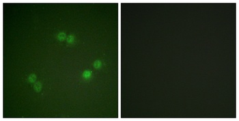 Splicing factor 1 (phospho Ser82) rabbit pAb
