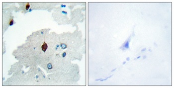 PBF antibody