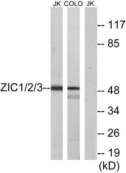 Zic1/2/3 antibody