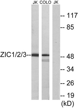 Zic1/2/3 rabbit pAb