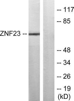 ZNF23 rabbit pAb