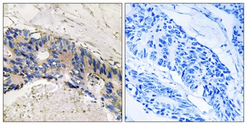CA I rabbit pAb Antibody