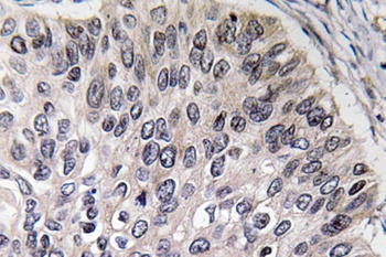 CA II rabbit pAb Antibody