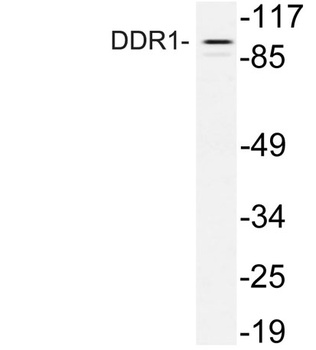 DDR1 rabbit pAb Antibody