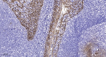 Frizzled-5 rabbit pAb