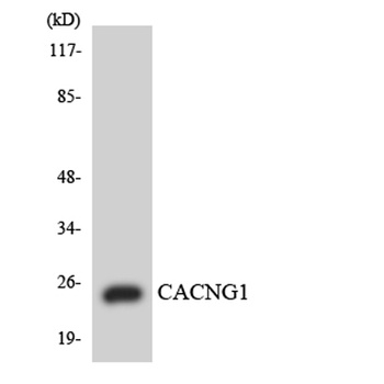 L-type Ca++ CP γ1 rabbit pAb