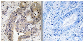 CAD (phospho Thr456) rabbit pAb