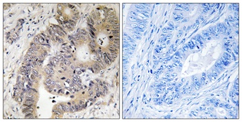 CAD (phospho-Thr456) antibody