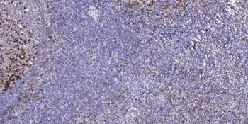 CARD 14 antibody