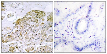 TFEB antibody