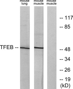 TFEB rabbit pAb