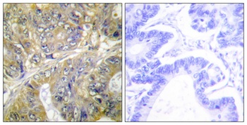 Eps8L3 antibody