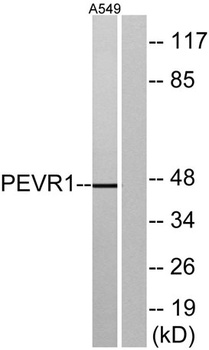 GPR172A rabbit pAb