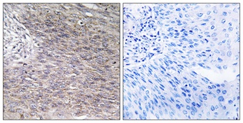 CHSY2 antibody