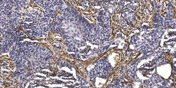 Microcephalin rabbit pAb