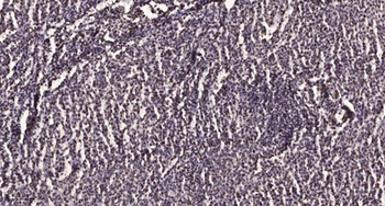 ZNF668 antibody