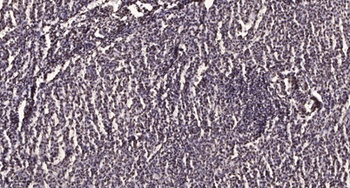 ZNF668 rabbit pAb