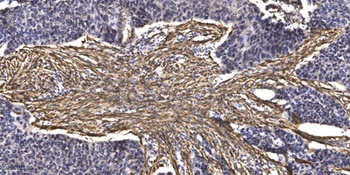 CEP76 rabbit pAb