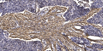 CEP76 antibody