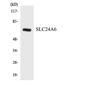 NCKX6 antibody