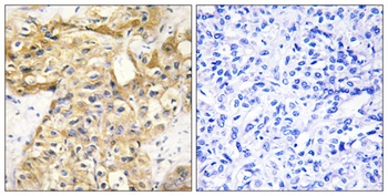 COL18A1 antibody