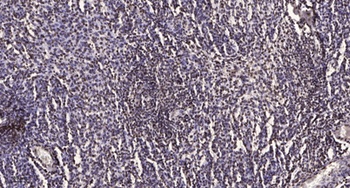 MKP-7 antibody