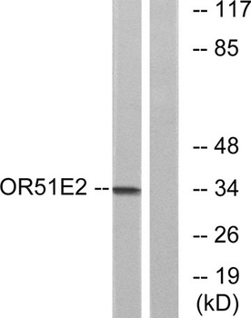 PSGR antibody