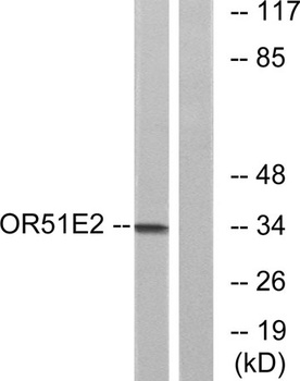PSGR rabbit pAb Antibody