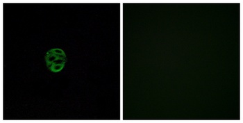 Olfactory receptor 2AE1 rabbit pAb