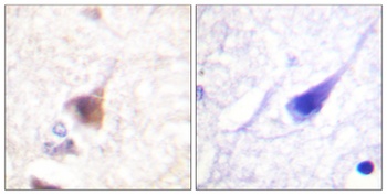 CaMKIV (phospho-Thr200) antibody