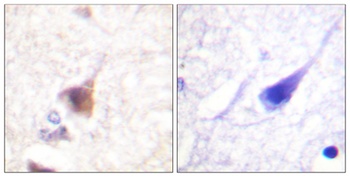 CaMKIV (phospho Thr200) rabbit pAb