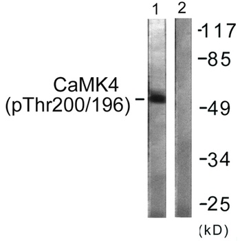 CaMKIV (phospho Thr200) rabbit pAb