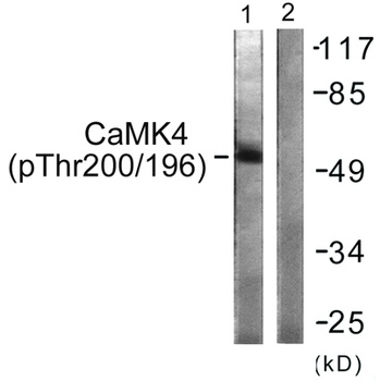 CaMKIV (phospho-Thr200) antibody