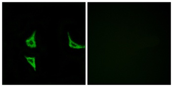 CaMKIIα/δ (phospho Thr286) rabbit pAb