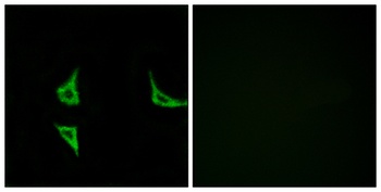 CaMKII alpha/delta (phospho-Thr286) antibody