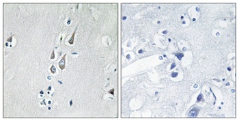 CaMKII alpha/delta (phospho-Thr286) antibody