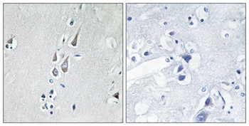 CaMKIIα/δ (phospho Thr286) rabbit pAb