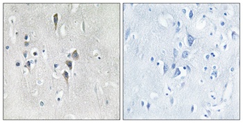 CaMKII alpha/delta antibody